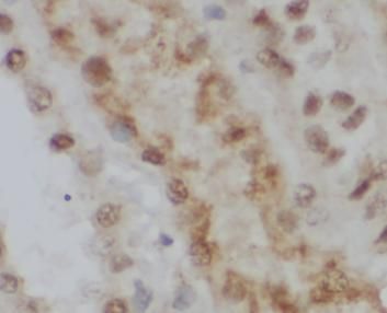 CALML6 Antibody - BSA Free