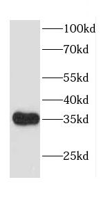 CACNG5 Antibody - BSA Free