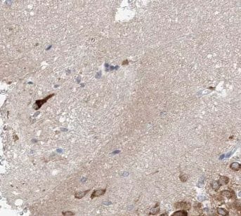 Stargazin Antibody - BSA Free