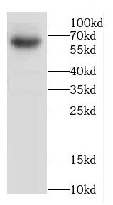 CACNB4 Antibody - BSA Free