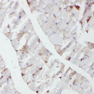 CACNA1S Antibody - BSA Free