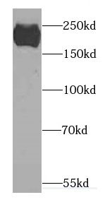 CACNA1S Antibody - BSA Free