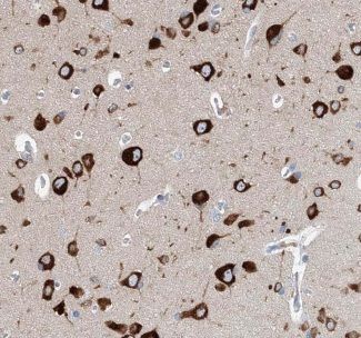 Cav2.2 Antibody - BSA Free