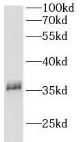 CA11 Antibody - BSA Free