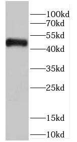 CARNMT1 Antibody - BSA Free