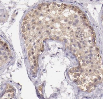 MALSU1 Antibody - BSA Free