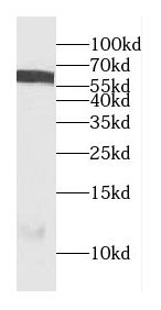 CEP85L Antibody - BSA Free
