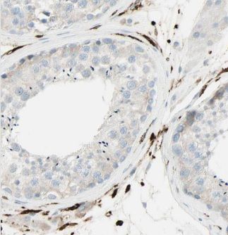 CEP85L Antibody - BSA Free