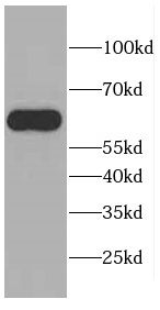 CEP57L1 Antibody - BSA Free