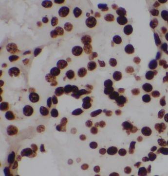 OARD1 Antibody - BSA Free