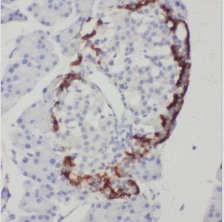 C5orf24 Antibody - BSA Free