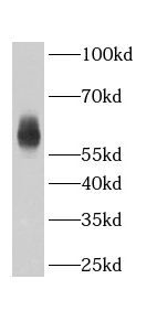 ABHD18 Antibody - BSA Free