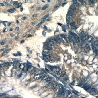 NOA1 Antibody - BSA Free