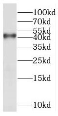 XXYLT1 Antibody - BSA Free