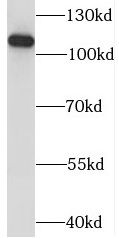 KANSL1L Antibody - BSA Free