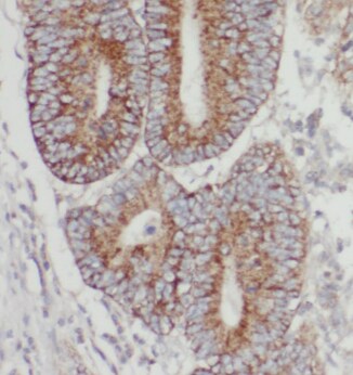 TMEM74B Antibody - BSA Free