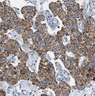 TMEM230 Antibody - BSA Free