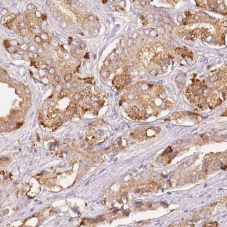 FNDC11 Antibody - BSA Free