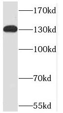 C20orf194 Antibody - BSA Free