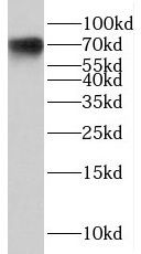 CNBD2 Antibody - BSA Free