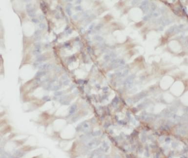 PPDPF Antibody - BSA Free