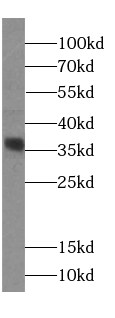 MENT Antibody - BSA Free