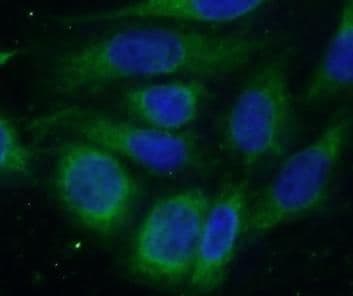 METTL18 Antibody - BSA Free
