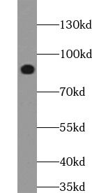 LRIF1 Antibody - BSA Free