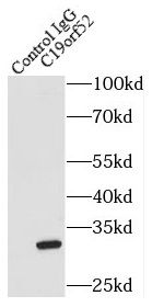 TIMM29 Antibody - BSA Free