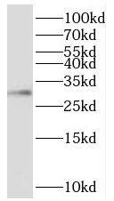 TIMM29 Antibody - BSA Free