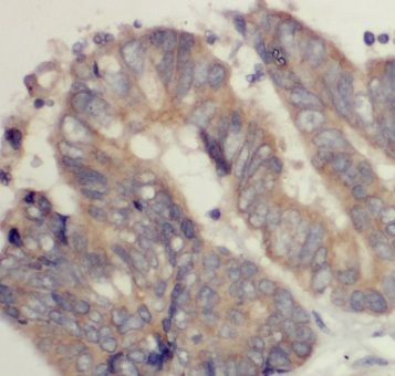 Mic1 Antibody - BSA Free