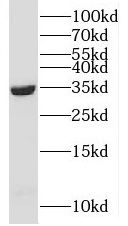 CCDC189 Antibody - BSA Free