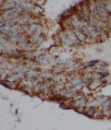 SMCO3 Antibody - BSA Free