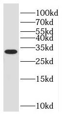 NKAPD1 Antibody - BSA Free