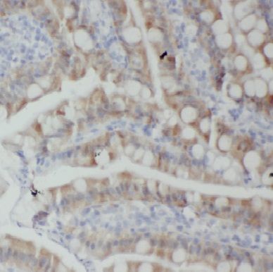 C11orf49 Antibody - BSA Free