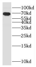 CCDC7 Antibody - BSA Free