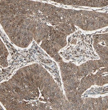 CCDC7 Antibody - BSA Free