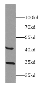BTBD8 Antibody - BSA Free