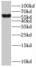 BTBD16 Antibody - BSA Free