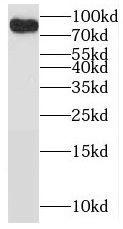BRSK2 Antibody - BSA Free