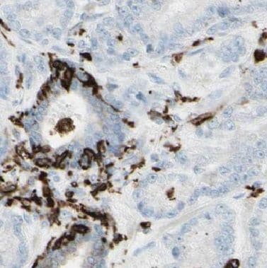 BRSK2 Antibody - BSA Free