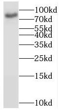 BRSK1 Antibody - BSA Free
