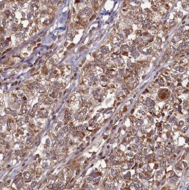 BRSK1 Antibody - BSA Free
