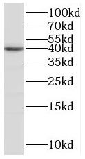 BRMS1L Antibody - BSA Free
