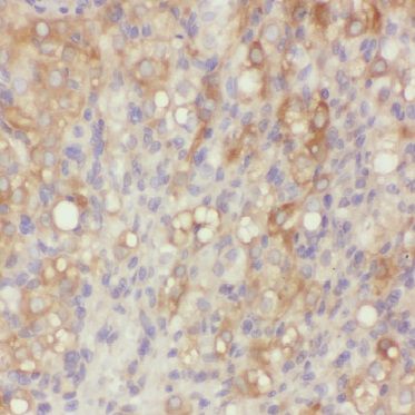 BIVM Antibody - BSA Free