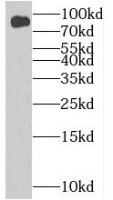BIN2 Antibody - BSA Free