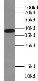 BHLHB5 Antibody - BSA Free