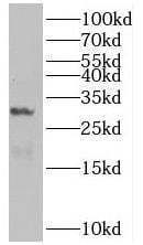 MIST1 Antibody - BSA Free