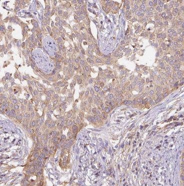 BET1L Antibody - BSA Free