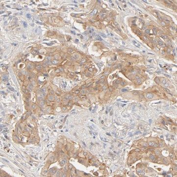 Begain Antibody - BSA Free